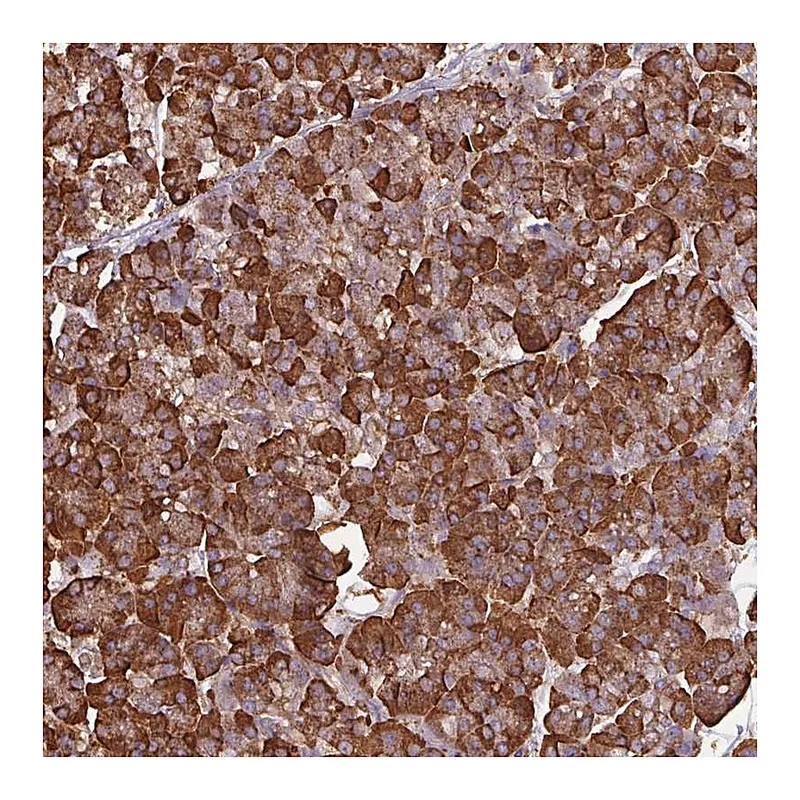 Atlas Antibodies Anti-WBSCR22 Antibody