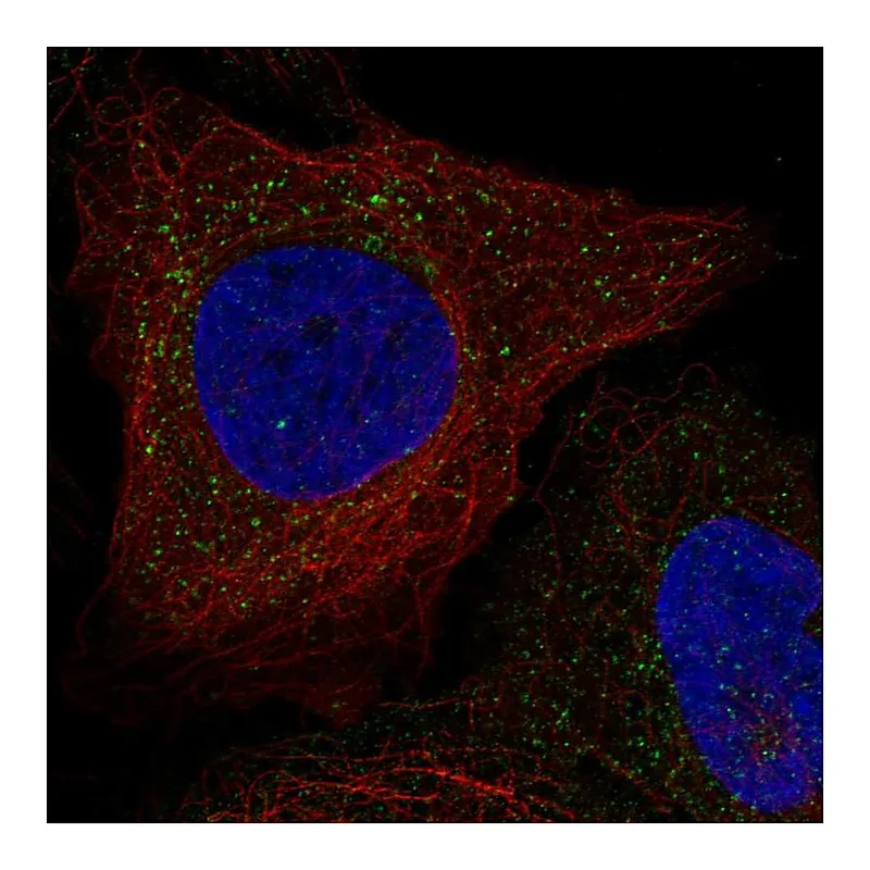 Atlas Antibodies Anti-WBSCR28 Antibody