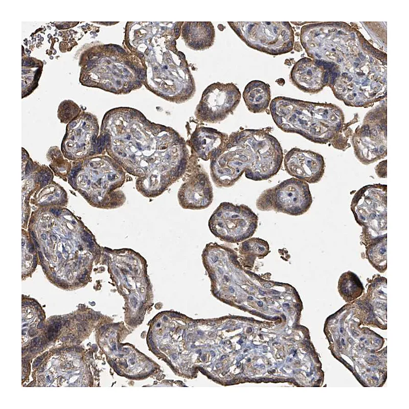 Atlas Antibodies Anti-WDFY1 Antibody