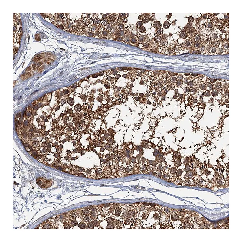 Atlas Antibodies Anti-WDCP Antibody