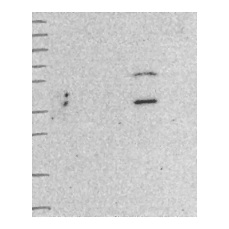 Atlas Antibodies Anti-WDFY2 Antibody