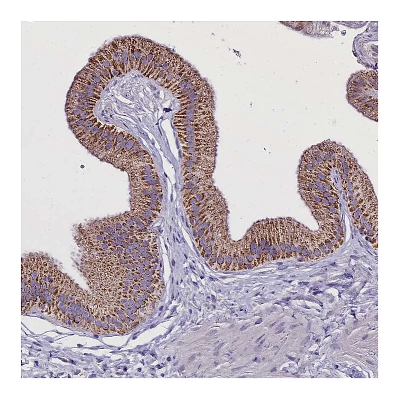 Atlas Antibodies Anti-WDFY3 Antibody