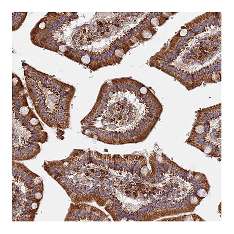 Atlas Antibodies Anti-WDFY3 Antibody