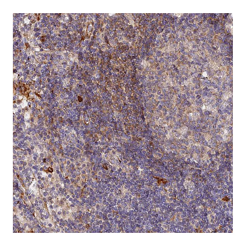 Atlas Antibodies Anti-WDFY4 Antibody