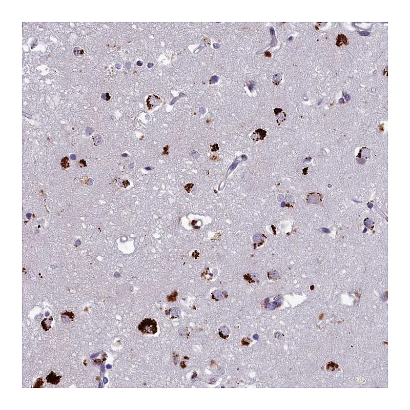 Atlas Antibodies Anti-WDPCP Antibody