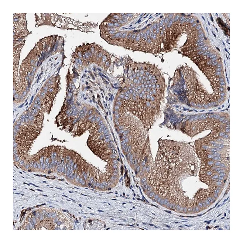 Atlas Antibodies Anti-WDR11 Antibody