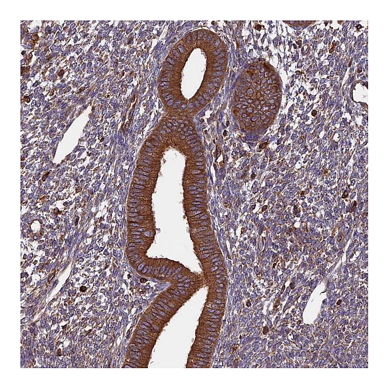 Atlas Antibodies Anti-WDR1 Antibody