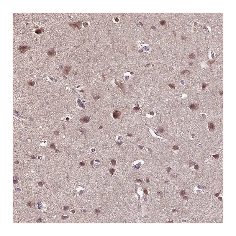 Atlas Antibodies Anti-WDR17 Antibody