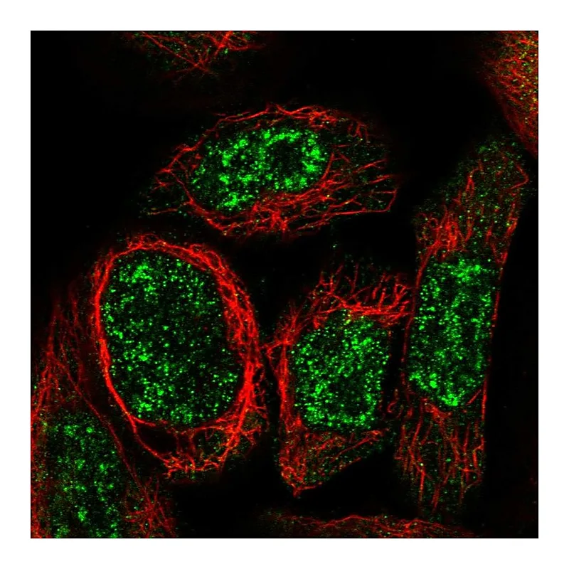 Atlas Antibodies Anti-WDR17 Antibody