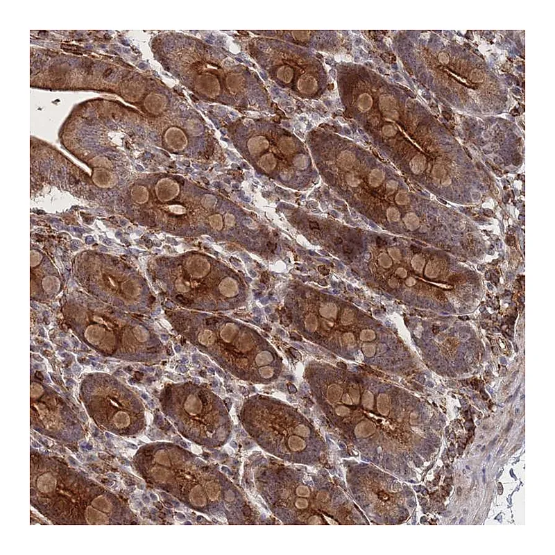 Atlas Antibodies Anti-WDR18 Antibody