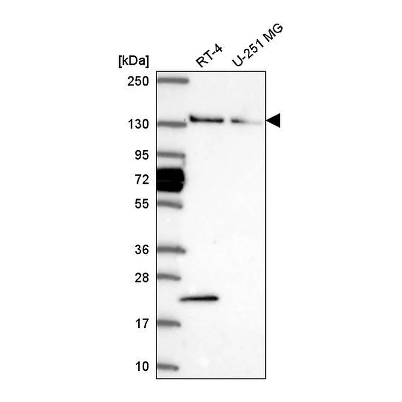 Atlas Antibodies Anti-WDR19 Antibody