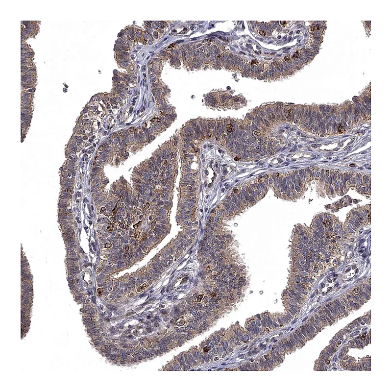 Atlas Antibodies Anti-WDR19 Antibody