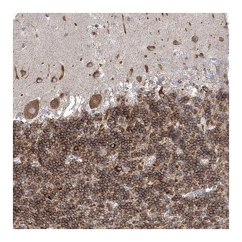 Atlas Antibodies Anti-WDR27 Antibody