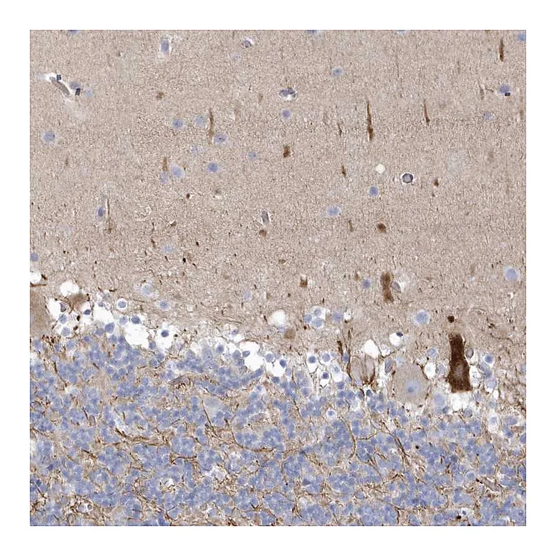 Atlas Antibodies Anti-WDR27 Antibody