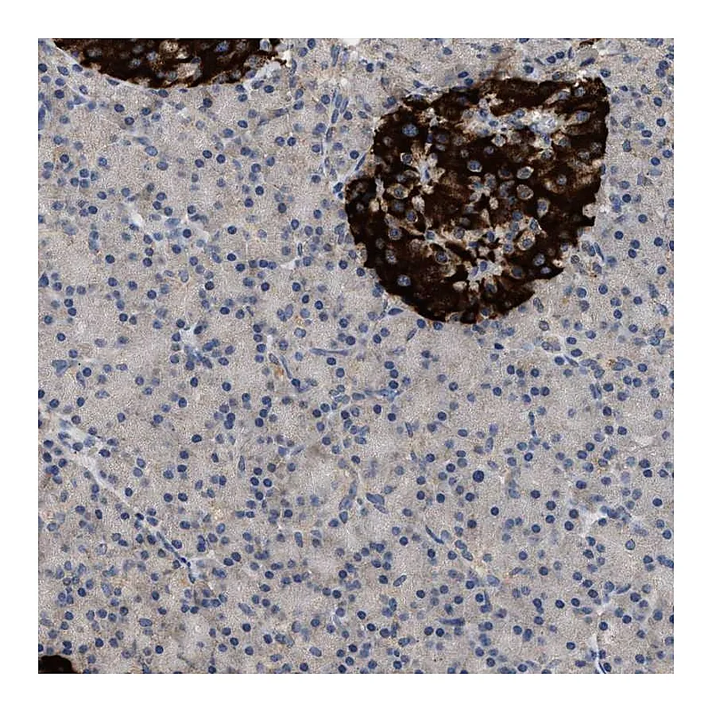 Atlas Antibodies Anti-WDR31 Antibody