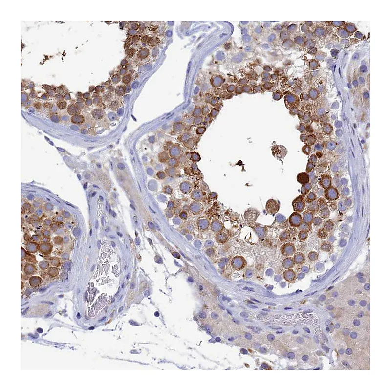 Atlas Antibodies Anti-WDR35 Antibody