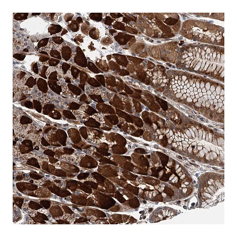 Atlas Antibodies Anti-WDR34 Antibody