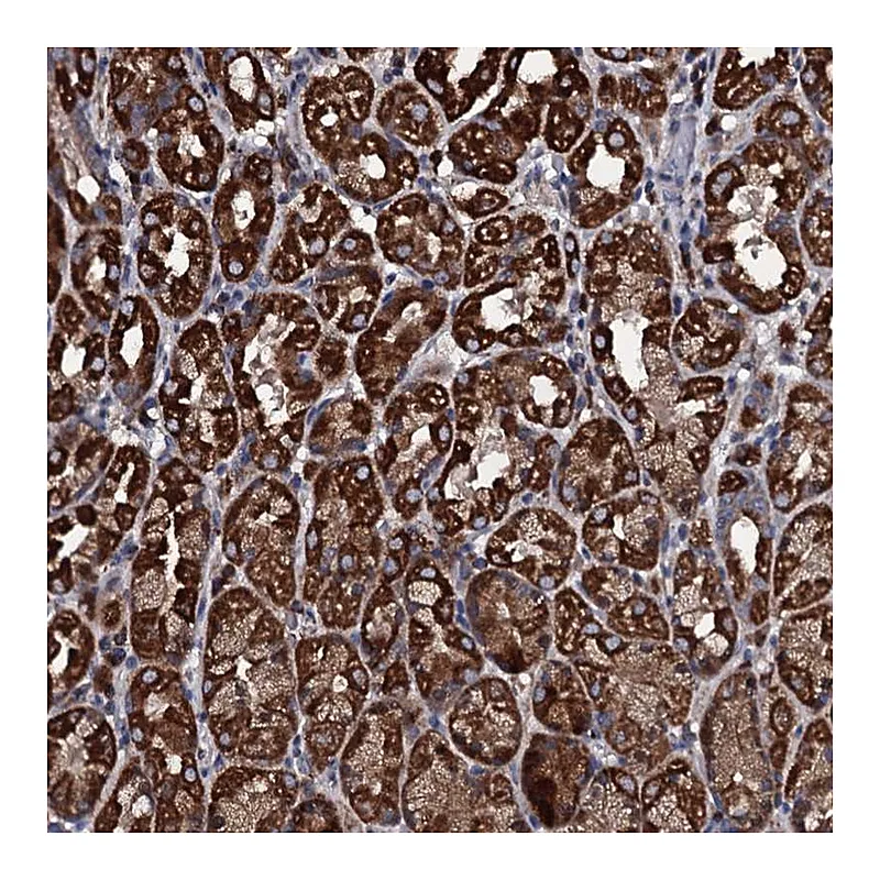 Atlas Antibodies Anti-WDR34 Antibody