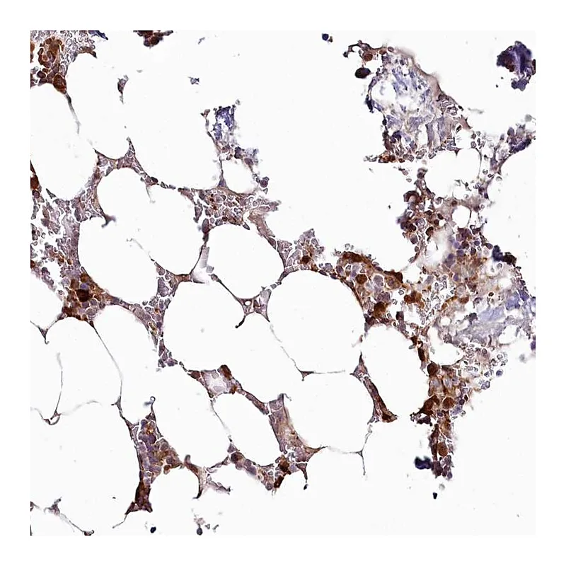 Atlas Antibodies Anti-WDR36 Antibody