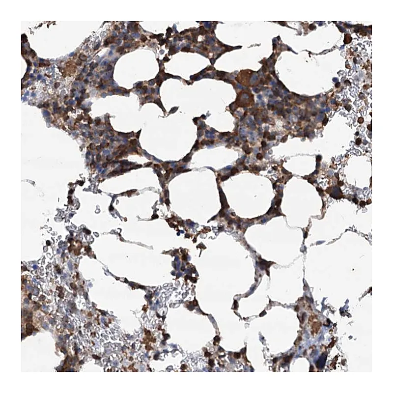 Atlas Antibodies Anti-WDR36 Antibody