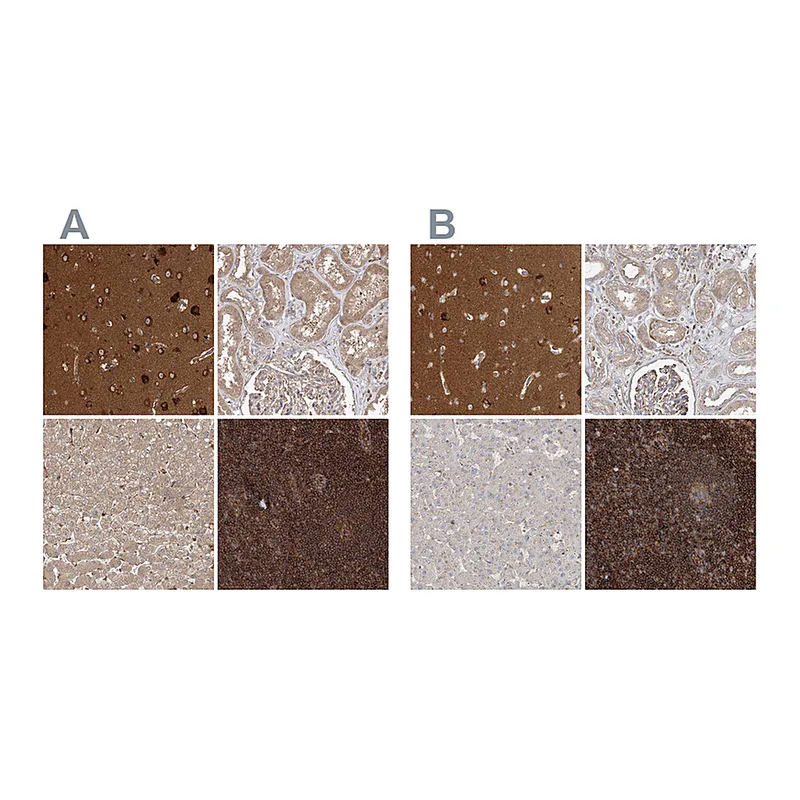 Atlas Antibodies Anti-WDR37 Antibody