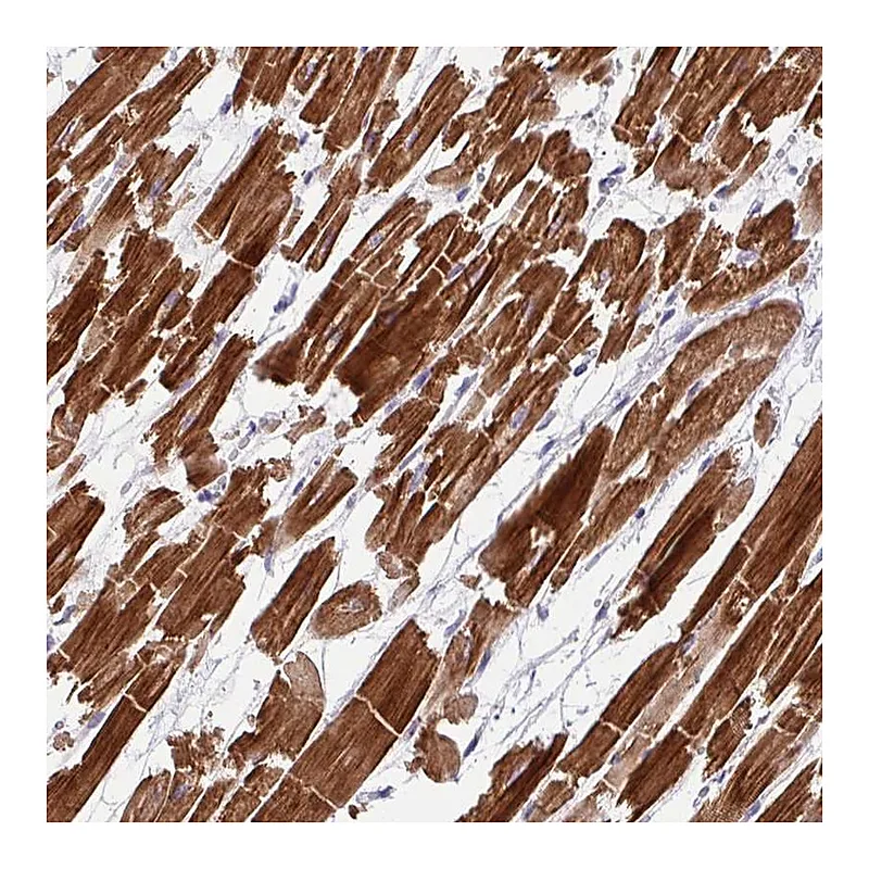 Atlas Antibodies Anti-WDR38 Antibody