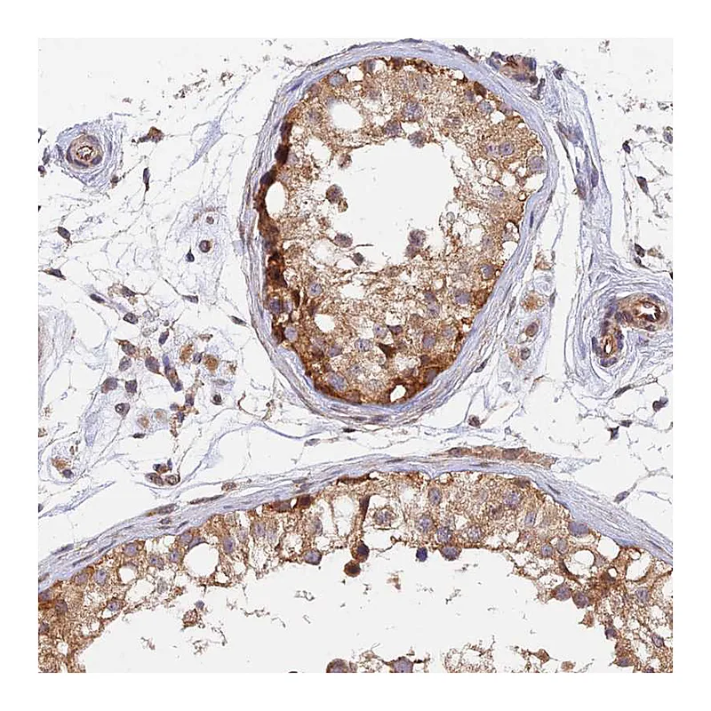Atlas Antibodies Anti-WDR41 Antibody