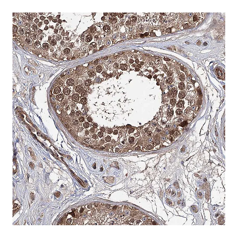 Atlas Antibodies Anti-WDR48 Antibody