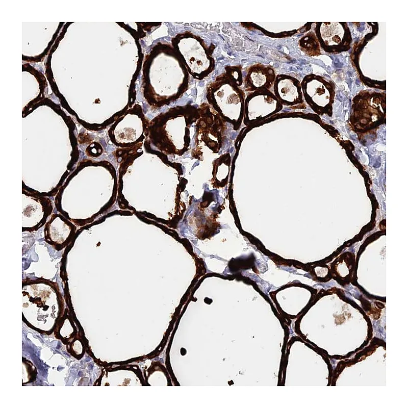 Atlas Antibodies Anti-WDR46 Antibody