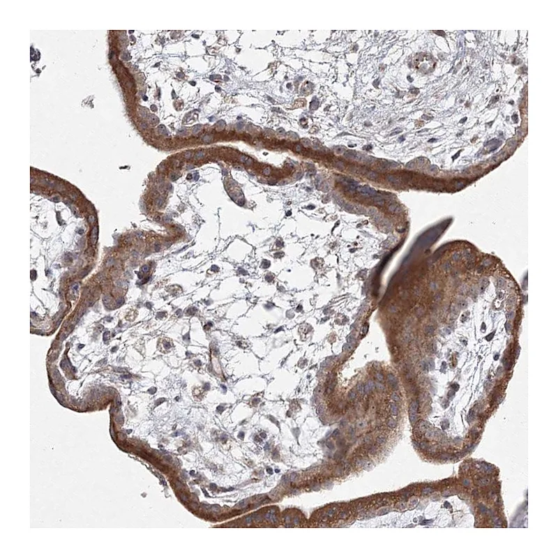 Atlas Antibodies Anti-WDR49 Antibody