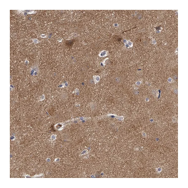 Atlas Antibodies Anti-WDR47 Antibody