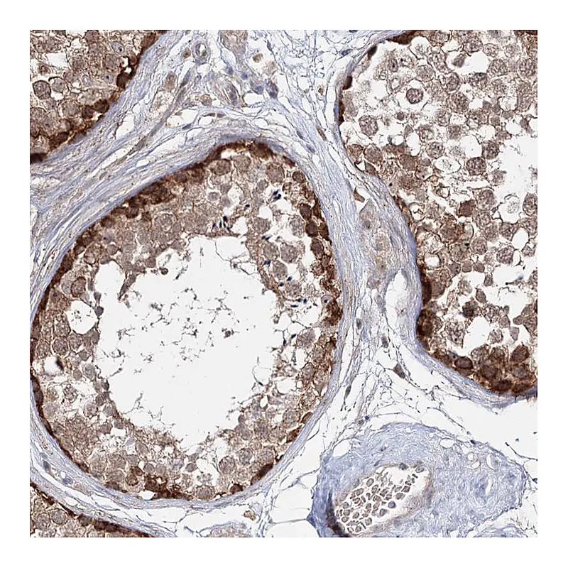 Atlas Antibodies Anti-WDR44 Antibody