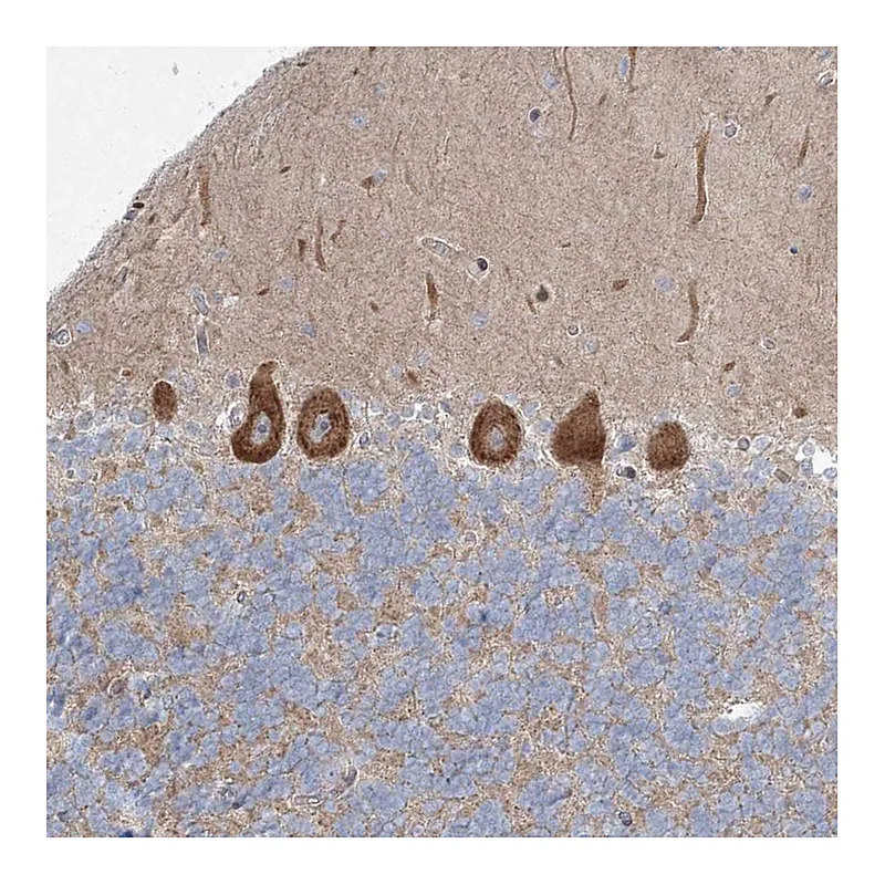 Atlas Antibodies Anti-WDR49 Antibody