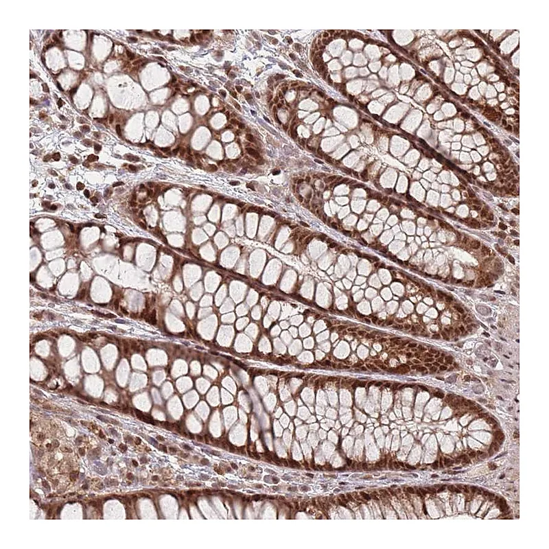 Atlas Antibodies Anti-WDR55 Antibody