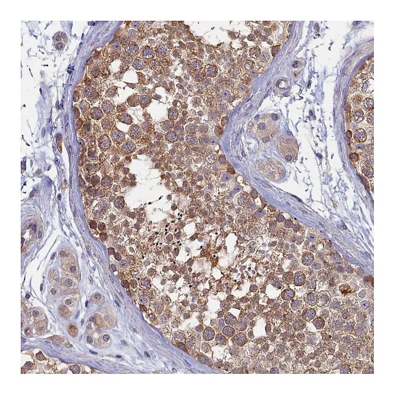 Atlas Antibodies Anti-WDR59 Antibody