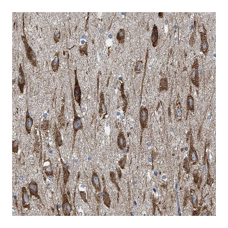 Atlas Antibodies Anti-WDR60 Antibody