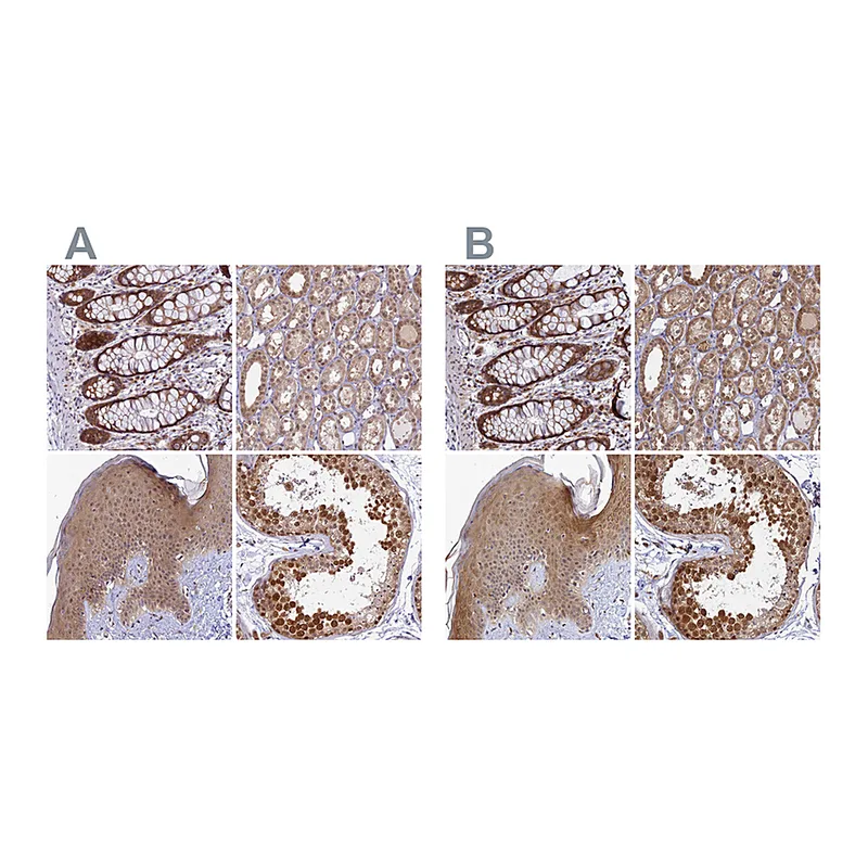 Atlas Antibodies Anti-WDR61 Antibody