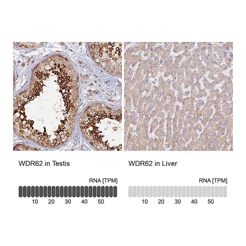Atlas Antibodies Anti-WDR62 Antibody
