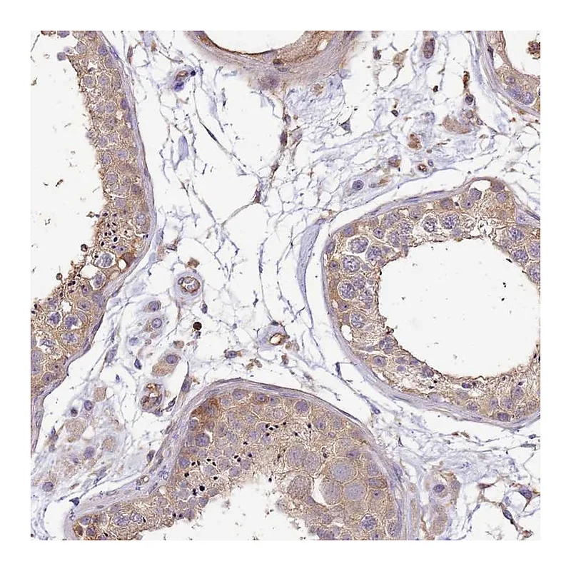Atlas Antibodies Anti-WDR64 Antibody