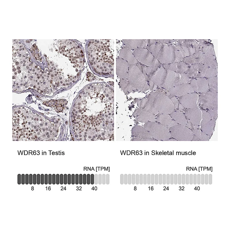 Atlas Antibodies Anti-WDR63 Antibody