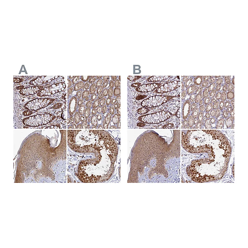 Atlas Antibodies Anti-WDR61 Antibody