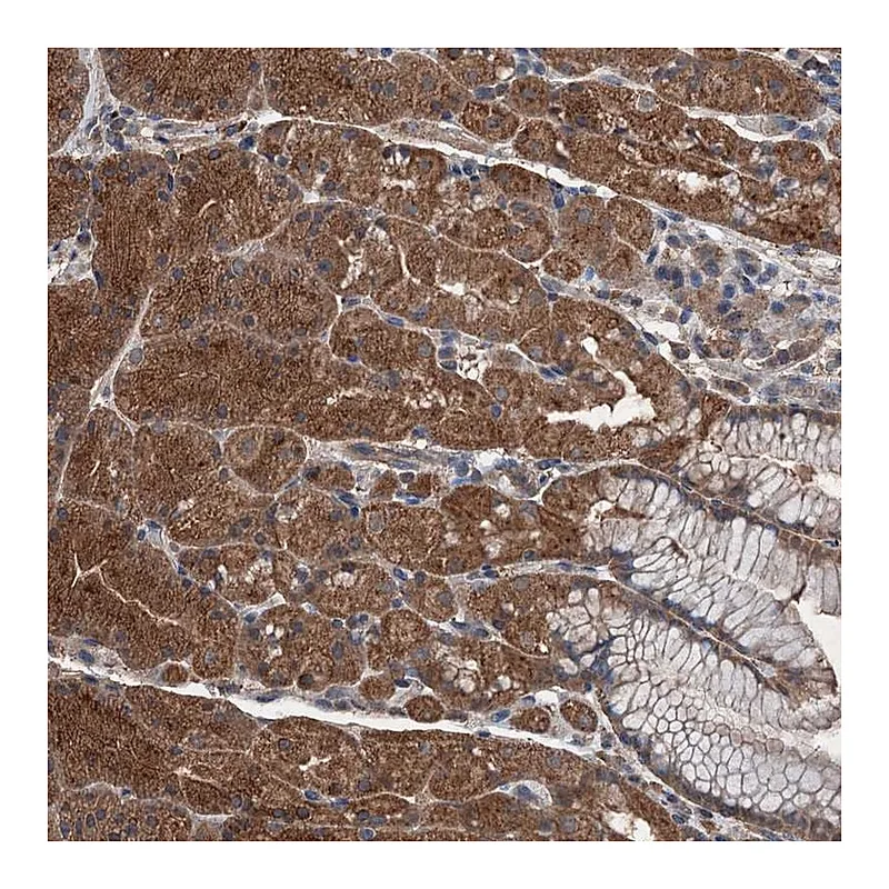 Atlas Antibodies Anti-WDR66 Antibody