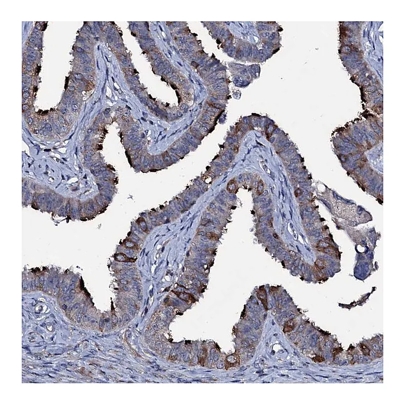 Atlas Antibodies Anti-WDR66 Antibody