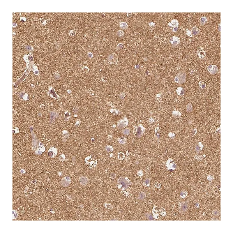 Atlas Antibodies Anti-WDR7 Antibody