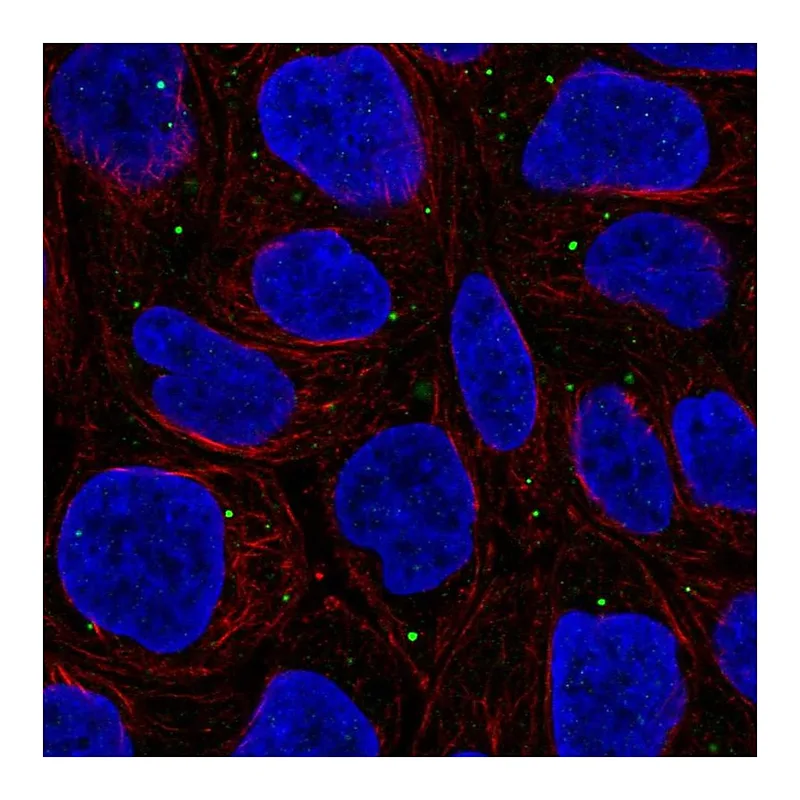 Atlas Antibodies Anti-WDR72 Antibody