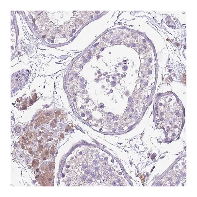 Atlas Antibodies Anti-WDR70 Antibody