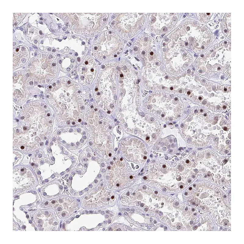 Atlas Antibodies Anti-WDR72 Antibody