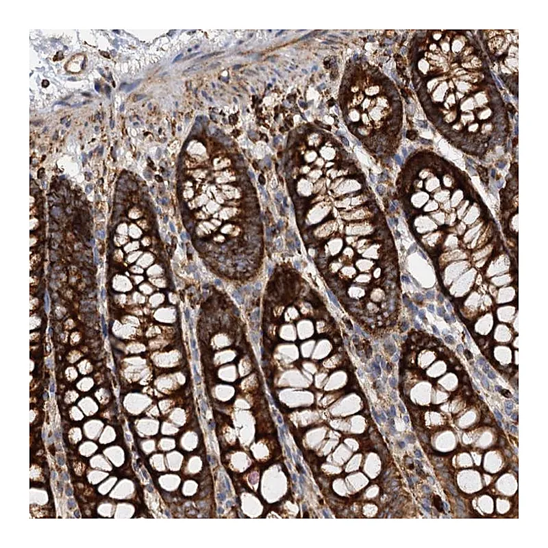 Atlas Antibodies Anti-WDR73 Antibody