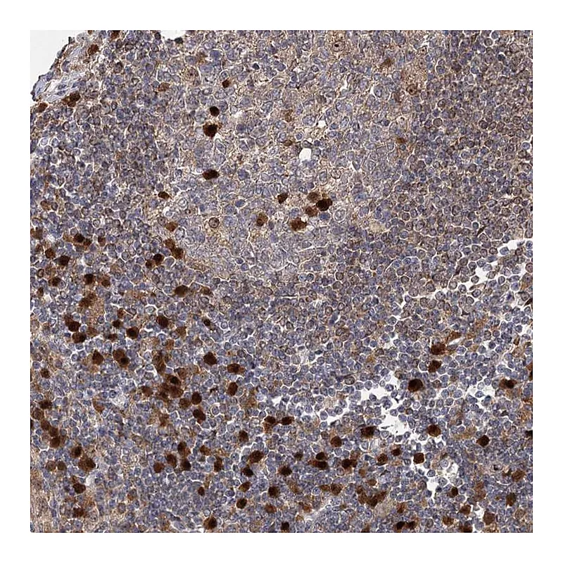 Atlas Antibodies Anti-WDR75 Antibody