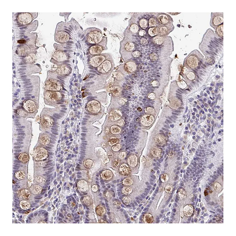 Atlas Antibodies Anti-WDR72 Antibody